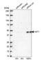 Histone Acetyltransferase 1 antibody, HPA036788, Atlas Antibodies, Western Blot image 