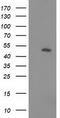 Phosphatidylinositol-5-Phosphate 4-Kinase Type 2 Alpha antibody, CF502271, Origene, Western Blot image 
