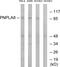 Calcium-independent phospholipase A2-gamma antibody, GTX87080, GeneTex, Western Blot image 