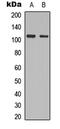 Protein Kinase D2 antibody, abx121673, Abbexa, Western Blot image 