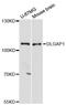 Disks large-associated protein 1 antibody, LS-C748123, Lifespan Biosciences, Western Blot image 
