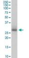 PIH1 domain-containing protein 1 antibody, H00055011-B01P, Novus Biologicals, Western Blot image 