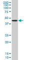 Protein NDRG2 antibody, LS-C139347, Lifespan Biosciences, Western Blot image 