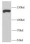Elongation Factor Tu GTP Binding Domain Containing 2 antibody, FNab02664, FineTest, Western Blot image 