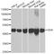 Guanine Deaminase antibody, A6441, ABclonal Technology, Western Blot image 