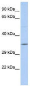Putative SCAN domain-containing protein 2 antibody, TA339540, Origene, Western Blot image 