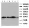 3,2-trans-enoyl-CoA isomerase, mitochondrial antibody, LS-C312910, Lifespan Biosciences, Western Blot image 