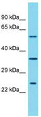 SHOC2 Leucine Rich Repeat Scaffold Protein antibody, TA338107, Origene, Western Blot image 