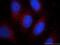 Galactosidase Alpha antibody, 66121-1-Ig, Proteintech Group, Immunofluorescence image 