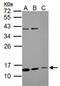 Rhophilin Associated Tail Protein 1B antibody, PA5-34792, Invitrogen Antibodies, Western Blot image 
