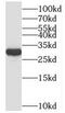 NSA2 Ribosome Biogenesis Factor antibody, FNab08713, FineTest, Western Blot image 