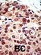 Protein arginine N-methyltransferase 3 antibody, abx025577, Abbexa, Immunohistochemistry paraffin image 