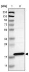 Ankyrin Repeat Domain 22 antibody, NBP1-81167, Novus Biologicals, Western Blot image 