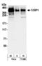 Tumor Protein P53 Binding Protein 1 antibody, A300-272A, Bethyl Labs, Western Blot image 
