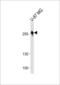 ROS Proto-Oncogene 1, Receptor Tyrosine Kinase antibody, LS-B15676, Lifespan Biosciences, Western Blot image 