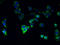 Cytochrome P450 Family 4 Subfamily F Member 11 antibody, A51305-100, Epigentek, Immunofluorescence image 