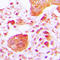 Phospholipase C Gamma 1 antibody, LS-C354053, Lifespan Biosciences, Immunohistochemistry frozen image 