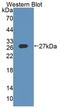 DM1 Protein Kinase antibody, LS-C374619, Lifespan Biosciences, Western Blot image 