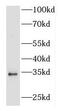 Fibroblast Growth Factor 5 antibody, FNab03094, FineTest, Western Blot image 