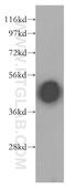 Arrestin 3 antibody, 11100-2-AP, Proteintech Group, Western Blot image 