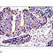 CRK Proto-Oncogene, Adaptor Protein antibody, LS-C814014, Lifespan Biosciences, Immunohistochemistry paraffin image 