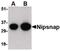 Protein NipSnap homolog 1 antibody, PA5-20500, Invitrogen Antibodies, Western Blot image 