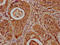 Histone Cluster 1 H1 Family Member E antibody, LS-C676867, Lifespan Biosciences, Immunohistochemistry paraffin image 