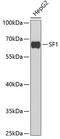 Splicing Factor 1 antibody, GTX54670, GeneTex, Western Blot image 