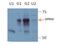 GPR50 antibody, 21514-1-AP, Proteintech Group, Western Blot image 