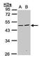 Sialic Acid Binding Ig Like Lectin 9 antibody, PA5-21830, Invitrogen Antibodies, Western Blot image 