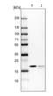 RLC antibody, NBP2-54719, Novus Biologicals, Western Blot image 