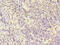 Lymphocyte Cytosolic Protein 1 antibody, A50334-100, Epigentek, Immunohistochemistry paraffin image 