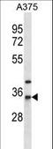 N-Acetyltransferase 1 antibody, LS-C158359, Lifespan Biosciences, Western Blot image 