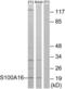 Protein S100-A16 antibody, LS-C120269, Lifespan Biosciences, Western Blot image 