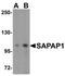 Disks large-associated protein 1 antibody, NBP1-76911, Novus Biologicals, Western Blot image 