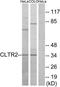 Cysteinyl Leukotriene Receptor 2 antibody, TA315644, Origene, Western Blot image 