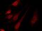MuRF-1 antibody, GTX02420, GeneTex, Immunofluorescence image 