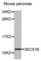 SEC61 Translocon Beta Subunit antibody, abx002643, Abbexa, Western Blot image 