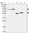 SH3 Domain Containing 21 antibody, PA5-59915, Invitrogen Antibodies, Western Blot image 