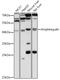 Amphiregulin antibody, GTX55511, GeneTex, Western Blot image 