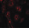 AP-3 complex subunit sigma-1 antibody, LS-C144389, Lifespan Biosciences, Immunofluorescence image 