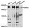 SMG6 Nonsense Mediated MRNA Decay Factor antibody, abx136051, Abbexa, Western Blot image 