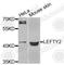 Left-right determination factor 2 antibody, A9846, ABclonal Technology, Western Blot image 