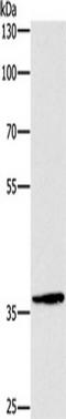 Dual Specificity Phosphatase 2 antibody, TA351148, Origene, Western Blot image 