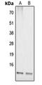 Cytochrome C Oxidase Copper Chaperone COX17 antibody, orb214959, Biorbyt, Western Blot image 