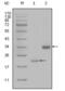 Lipoprotein(A) antibody, abx011855, Abbexa, Enzyme Linked Immunosorbent Assay image 