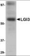 Leucine-rich repeat LGI family member 3 antibody, orb94249, Biorbyt, Western Blot image 