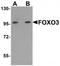Forkhead Box O3 antibody, TA319652, Origene, Western Blot image 