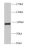 Phosphodiesterase 4D antibody, FNab06255, FineTest, Western Blot image 