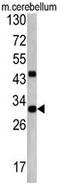 ZW10 Interacting Kinetochore Protein antibody, AP17856PU-N, Origene, Western Blot image 